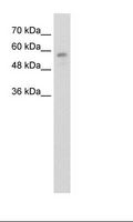 RBCK1 Antibody - Jurkat Cell Lysate.  This image was taken for the unconjugated form of this product. Other forms have not been tested.