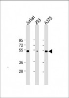 RBCK1 Antibody - All lanes: Anti-RBCK1 (UBCE7IP3) Antibody at 1:2000 dilution Lane 1: Jurkat whole cell lysate Lane 2: 293 whole cell lysate Lane 3: A375 whole cell lysate Lysates/proteins at 20 µg per lane. Secondary Goat Anti-mouse IgG, (H+L), Peroxidase conjugated at 1/10000 dilution. Predicted band size: 58 kDa Blocking/Dilution buffer: 5% NFDM/TBST.
