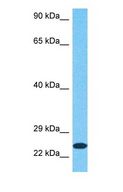RBCK1 Antibody - Western blot of HOIL1 Antibody with human 721_B Whole Cell lysate.  This image was taken for the unconjugated form of this product. Other forms have not been tested.