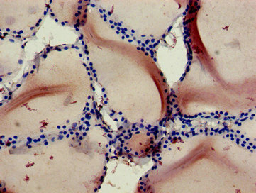 RBCK1 Antibody - Immunohistochemistry of paraffin-embedded human thyroid tissue at dilution of 1:100