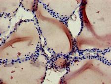 RBCK1 Antibody - Immunohistochemistry of paraffin-embedded human thyroid tissue at dilution of 1:100
