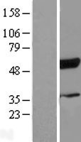 RBCK1 Protein - Western validation with an anti-DDK antibody * L: Control HEK293 lysate R: Over-expression lysate