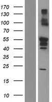 RBCK1 Protein - Western validation with an anti-DDK antibody * L: Control HEK293 lysate R: Over-expression lysate