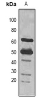 rbcL Antibody - Western blot analysis of Rubisco Large Chain expression in Arabidopsis thaliana (A) whole cell lysates.