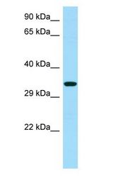 RBFA Antibody - RBFA antibody Western Blot of HeLa.  This image was taken for the unconjugated form of this product. Other forms have not been tested.