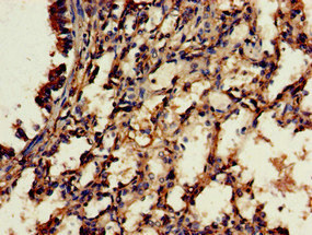 RBFA Antibody - Immunohistochemistry of paraffin-embedded human lung tissue at dilution of 1:100