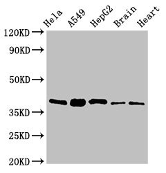 RBFA Antibody - Western Blot Positive WB detected in:Hela whole cell lysate,A549 whole cell lysate,HepG2 whole cell lysate,Mouse brain tissue,Rat heart tissue All Lanes:RBFA antibody at 2µg/ml Secondary Goat polyclonal to rabbit IgG at 1/50000 dilution Predicted band size: 39,28 KDa Observed band size: 39 KDa