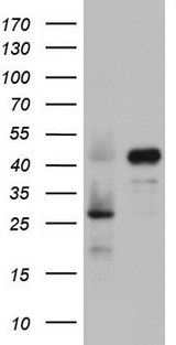 RBFOX1 / A2BP1 Antibody - HEK293T cells were transfected with the pCMV6-ENTRY control (Left lane) or pCMV6-ENTRY RBFOX1 (Right lane) cDNA for 48 hrs and lysed. Equivalent amounts of cell lysates (5 ug per lane) were separated by SDS-PAGE and immunoblotted with anti-RBFOX1.