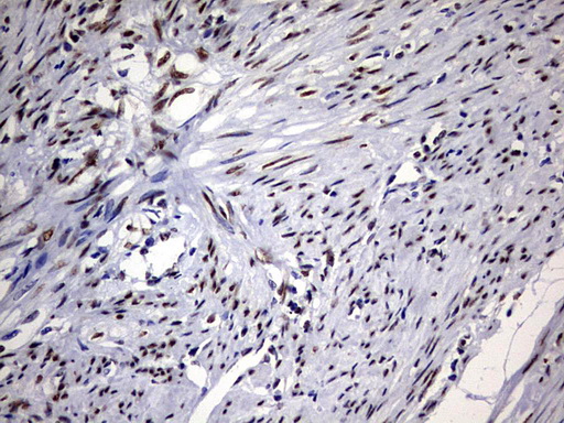 RBFOX1 / A2BP1 Antibody - IHC of paraffin-embedded Human endometrium tissue using anti-RBFOX1 mouse monoclonal antibody. (Heat-induced epitope retrieval by 1 mM EDTA in 10mM Tris, pH8.5, 120°C for 3min).