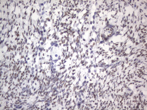RBFOX1 / A2BP1 Antibody - IHC of paraffin-embedded Human Ovary tissue using anti-RBFOX1 mouse monoclonal antibody. (Heat-induced epitope retrieval by 1 mM EDTA in 10mM Tris, pH8.5, 120°C for 3min).
