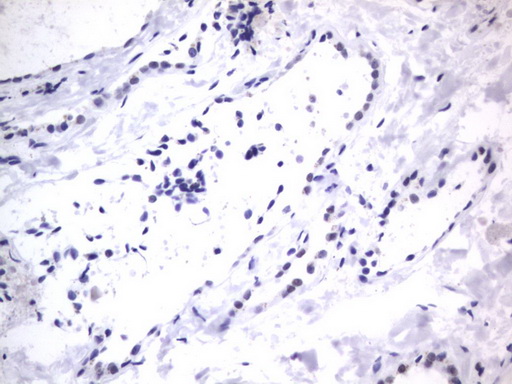 RBFOX1 / A2BP1 Antibody - IHC of paraffin-embedded Human thyroid tissue using anti-RBFOX1 mouse monoclonal antibody. (Heat-induced epitope retrieval by 1 mM EDTA in 10mM Tris, pH8.5, 120°C for 3min).