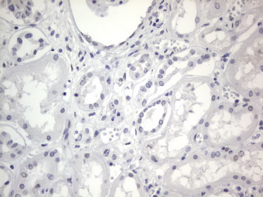 RBFOX1 / A2BP1 Antibody - IHC of paraffin-embedded Human Kidney tissue using anti-RBFOX1 mouse monoclonal antibody. (Heat-induced epitope retrieval by 1 mM EDTA in 10mM Tris, pH8.5, 120°C for 3min).