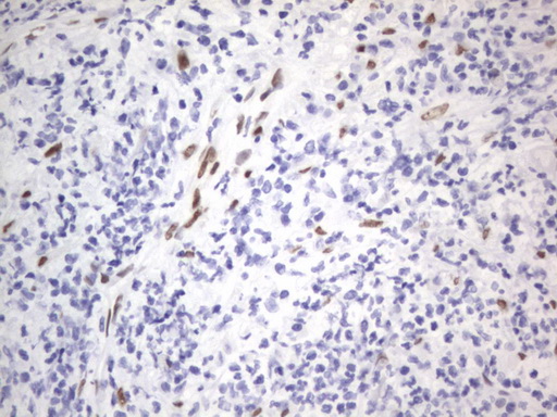 RBFOX1 / A2BP1 Antibody - IHC of paraffin-embedded Human lymph node tissue using anti-RBFOX1 mouse monoclonal antibody. (Heat-induced epitope retrieval by 1 mM EDTA in 10mM Tris, pH8.5, 120°C for 3min).