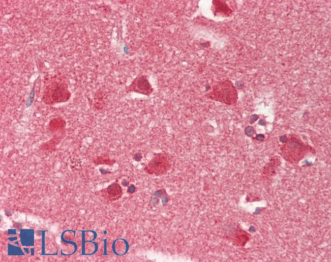 RBFOX1 / A2BP1 Antibody - Human Brain, Cortex: Formalin-Fixed, Paraffin-Embedded (FFPE).  This image was taken for the unconjugated form of this product. Other forms have not been tested.