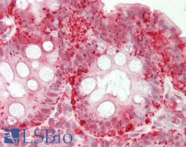 RBFOX1 / A2BP1 Antibody - Human Colon: Formalin-Fixed, Paraffin-Embedded (FFPE).  This image was taken for the unconjugated form of this product. Other forms have not been tested.