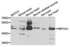 RBFOX1 / A2BP1 Antibody - Western blot analysis of extracts of various cells.