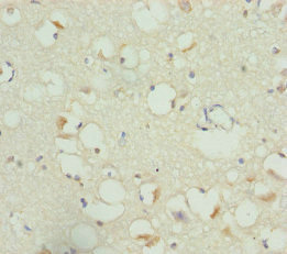 RBFOX1 / A2BP1 Antibody - Immunohistochemistry of paraffin-embedded human brain tissue at dilution of 1:100