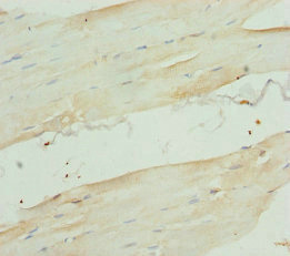 RBFOX1 / A2BP1 Antibody - Immunohistochemistry of paraffin-embedded human skeletal muscle tissue at dilution of 1:100