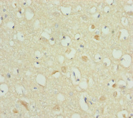 RBFOX1 / A2BP1 Antibody - Immunohistochemistry of paraffin-embedded human brain tissue at dilution of 1:100