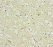 RBFOX1 / A2BP1 Antibody - Immunohistochemistry of paraffin-embedded human brain tissue at dilution of 1:100
