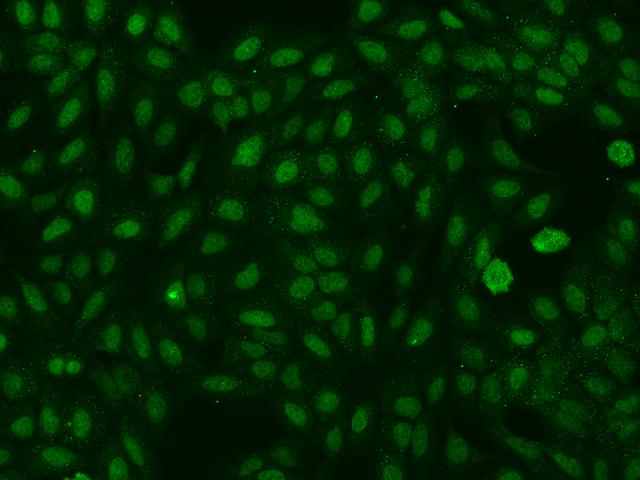 RBFOX1 / A2BP1 Antibody - Immunofluorescence staining of RBFOX1 in U2OS cells. Cells were fixed with 4% PFA, permeabilzed with 0.1% Triton X-100 in PBS, blocked with 10% serum, and incubated with rabbit anti-Human RBFOX1 polyclonal antibody (dilution ratio 1:200) at 4°C overnight. Then cells were stained with the Alexa Fluor 488-conjugated Goat Anti-rabbit IgG secondary antibody (green). Positive staining was localized to Nucleus and Cytoplasm.