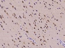 RBFOX1 / A2BP1 Antibody - Immunochemical staining of human RBFOX1 in human brain with rabbit polyclonal antibody at 1:2000 dilution, formalin-fixed paraffin embedded sections.