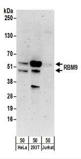 RBFOX2 / RBM9 Antibody - Detection of Human RBM9 by Western Blot. Samples: Whole cell lysate (50 ug) from HeLa, 293T, and Jurkat cells. Antibodies: Affinity purified rabbit anti-RBM9 antibody used for WB at 0.1 ug/ml. Detection: Chemiluminescence with an exposure time of 3 minutes.