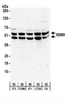 RBFOX2 / RBM9 Antibody - Detection of Mouse and Rat RBM9 by Western Blot. Samples: Whole cell lysate (50 ug) from NIH3T3, TCMK-1, 4T1, CT26.WT, and rat C6 cells. Antibodies: Affinity purified rabbit anti-RBM9 antibody used for WB at 0.5 ug/ml. Detection: Chemiluminescence with an exposure time of 3 minutes.