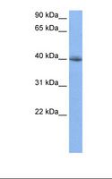 RBFOX2 / RBM9 Antibody - Jurkat cell lysate. Antibody concentration: 0.5 ug/ml. Gel concentration: 12%.  This image was taken for the unconjugated form of this product. Other forms have not been tested.