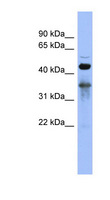 RBFOX2 / RBM9 Antibody - RBFOX2 / RBM9 antibody Western blot of NCI-H226 cell lysate. This image was taken for the unconjugated form of this product. Other forms have not been tested.