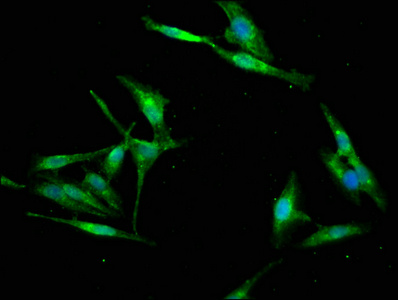 RBFOX2 / RBM9 Antibody - Immunofluorescence staining of Hela cells at a dilution of 1:133, counter-stained with DAPI. The cells were fixed in 4% formaldehyde, permeabilized using 0.2% Triton X-100 and blocked in 10% normal Goat Serum. The cells were then incubated with the antibody overnight at 4°C.The secondary antibody was Alexa Fluor 488-congugated AffiniPure Goat Anti-Rabbit IgG (H+L) .