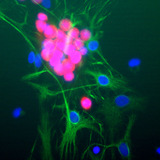 RBFOX3 / NEUN Antibody - Rat brain neural cultures stained with RBFOX3 / NEUN antibody (red), chicken polyclonal antibody to GFAP (green) and DNA (blue). The RBFOX3 / NEUN antibody antibody reveals strong nuclear and distal cytoplasmic staining for Fox3/NeuN and the complete absence of staining of astrocytes, which are staining with the GFAP antibody, and other kinds of non-neuronal cells. This Fox3/NeuN antibody is therefore an excellent marker of neuronal cells. Note that we have used the same immunogen to generate a rabbit polyclonal antibody to Fox3/NeuN, RPCA-Fox3.