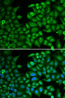 RBFOX3 / NEUN Antibody - Immunofluorescence analysis of MCF-7 cells.