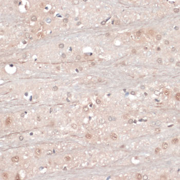 RBFOX3 / NEUN Antibody - Immunohistochemistry of paraffin-embedded rat brain using RBFOX3 antibodyat dilution of 1:100 (40x lens).