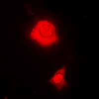 RBFOX3 / NEUN Antibody - Immunofluorescent analysis of RBFOX3 staining in MCF7 cells. Formalin-fixed cells were permeabilized with 0.1% Triton X-100 in TBS for 5-10 minutes and blocked with 3% BSA-PBS for 30 minutes at room temperature. Cells were probed with the primary antibody in 3% BSA-PBS and incubated overnight at 4 deg C in a humidified chamber. Cells were washed with PBST and incubated with a DyLight 594-conjugated secondary antibody (red) in PBS at room temperature in the dark.