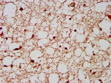 RBFOX3 / NEUN Antibody - Immunohistochemistry image at a dilution of 1:200 and staining in paraffin-embedded human brain tissue performed on a Leica BondTM system. After dewaxing and hydration, antigen retrieval was mediated by high pressure in a citrate buffer (pH 6.0) . Section was blocked with 10% normal goat serum 30min at RT. Then primary antibody (1% BSA) was incubated at 4 °C overnight. The primary is detected by a biotinylated secondary antibody and visualized using an HRP conjugated SP system.
