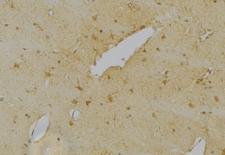 RBFOX3 / NEUN Antibody - 1:100 staining mouse brain tissue by IHC-P. The sample was formaldehyde fixed and a heat mediated antigen retrieval step in citrate buffer was performed. The sample was then blocked and incubated with the antibody for 1.5 hours at 22°C. An HRP conjugated goat anti-rabbit antibody was used as the secondary.