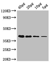 RBKS / Ribokinase Antibody - Western Blot Positive WB detected in: Rosseta bacteria lysate at 40µg, 20µg, 10µg, 5µg All lanes: rbsK antibody at 0.42µg/ml Secondary Goat polyclonal to rabbit IgG at 1/50000 dilution Predicted band size: 33 kDa Observed band size: 40 kDa