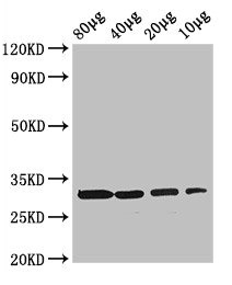 RBKS / Ribokinase Antibody - Western Blot Positive WB detected in: Rosseta bacteria lysate at 80µg, 40µg, 20µg, 10µg All lanes: rbsK antibody at 3µg/ml Secondary Goat polyclonal to rabbit IgG at 1/50000 dilution Predicted band size: 33 kDa Observed band size: 33 kDa