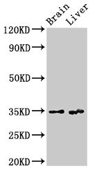 RBKS / Ribokinase Antibody - Western Blot Positive WB detected in: Rat brain tissue, Rat liver tissue All lanes: RBKS antibody at 3.4µg/ml Secondary Goat polyclonal to rabbit IgG at 1/50000 dilution Predicted band size: 35, 31 kDa Observed band size: 35 kDa