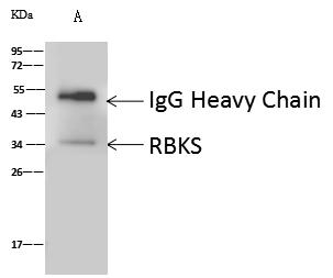 RBKS / Ribokinase Antibody - RBKS was immunoprecipitated using: Lane A: 0.5 mg HepG2 Whole Cell Lysate. 1 uL anti-RBKS rabbit polyclonal antibody and 60 ug of Immunomagnetic beads Protein A/G. Primary antibody: Anti-RBKS rabbit polyclonal antibody, at 1:500 dilution. Secondary antibody: Goat Anti-Rabbit IgG (H+L)/HRP at 1/10000 dilution. Developed using the ECL technique. Performed under reducing conditions. Predicted band size: 40 kDa. Observed band size: 35 kDa.