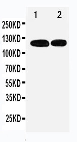 RBL1 / p107 Antibody - WB of RBL1 / p107 antibody. All lanes: Anti-RBL1 at 0.5ug/ml. Lane 1: 239T Whole Cell Lysate at 40ug. Lane 2: JURKAT Whole Cell Lysate at 40ug. Predicted bind size: 121KD. Observed bind size: 121KD.