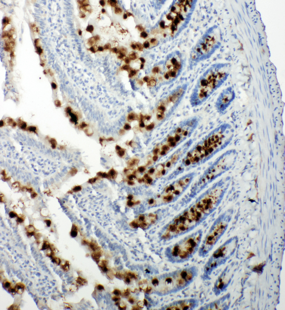 RBL1 / p107 Antibody - RBL1 / p107 antibody. IHC(P): Rat Intestine Tissue.