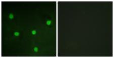 RBL1 / p107 Antibody - Immunofluorescence analysis of NIH/3T3 cells, using RBL1 Antibody. The picture on the right is blocked with the synthesized peptide.