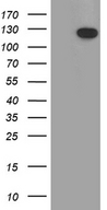 RBL1 / p107 Antibody - HEK293T cells were transfected with the pCMV6-ENTRY control. (Left lane) or pCMV6-ENTRY RBL1. (Right lane) cDNA for 48 hrs and lysed. Equivalent amounts of cell lysates. (5 ug per lane) were separated by SDS-PAGE and immunoblotted with anti-RBL1. (1:2000)