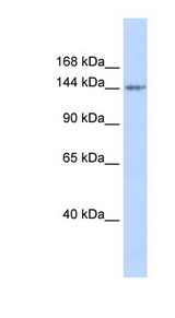 RBL1 / p107 Antibody - RBL1 / p107 antibody Western blot of Fetal Muscle lysate. This image was taken for the unconjugated form of this product. Other forms have not been tested.