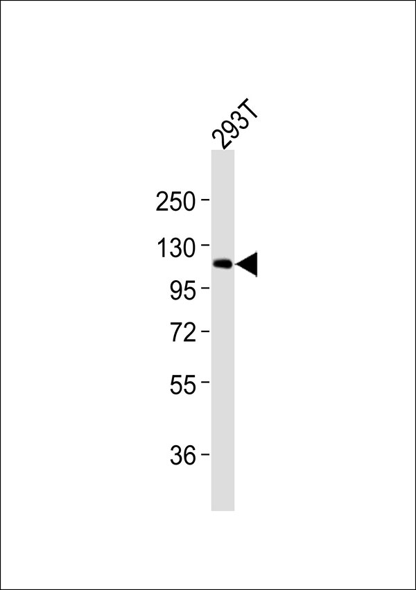 RBL1 / p107 Antibody - Anti-p107 Antibody at 1:1000 dilution + 293T whole cell lysates Lysates/proteins at 20 ug per lane. Secondary Goat Anti-Rabbit IgG, (H+L),Peroxidase conjugated at 1/10000 dilution Predicted band size : 121 kDa Blocking/Dilution buffer: 5% NFDM/TBST.
