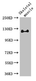 RBL1 / p107 Antibody - Western Blot Positive WB detected in: Mouse skeletal muscle tissue All lanes: RBL1 antibody at 3µg/ml Secondary Goat polyclonal to rabbit IgG at 1/50000 dilution Predicted band size: 121, 115 kDa Observed band size: 121 kDa