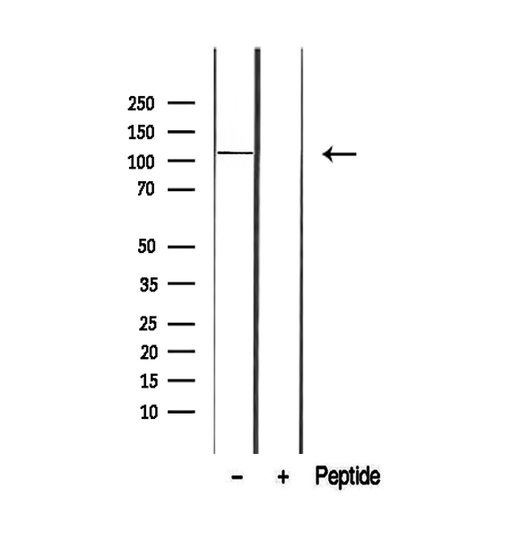 RBL1 / p107 Antibody - Western blot analysis of extracts of COLO 320 cells using p107 antibody.
