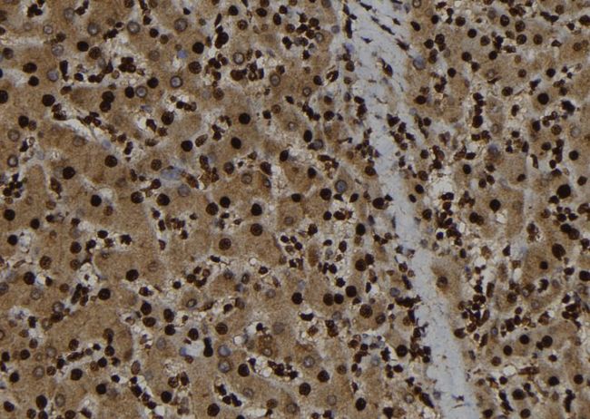 RBL1 / p107 Antibody - 1:100 staining human liver tissue by IHC-P. The sample was formaldehyde fixed and a heat mediated antigen retrieval step in citrate buffer was performed. The sample was then blocked and incubated with the antibody for 1.5 hours at 22°C. An HRP conjugated goat anti-rabbit antibody was used as the secondary.